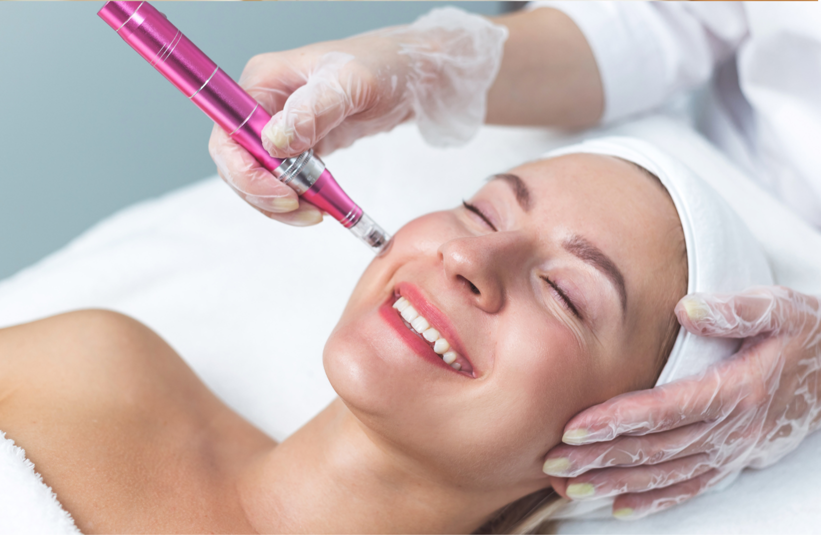 Microneedling in Temecula: Benefits, Results, and What to Expect