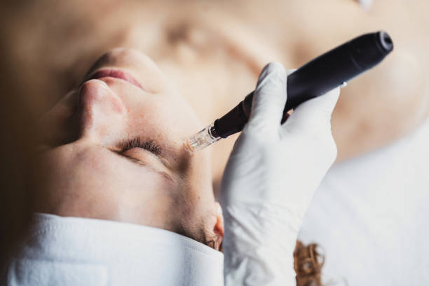 Young woman receiving face mesotherapy injection with derma pen on face for rejuvenation on the spa salon. Beauty woman face skin care. Beauty treatment and health care in professional beauty salon