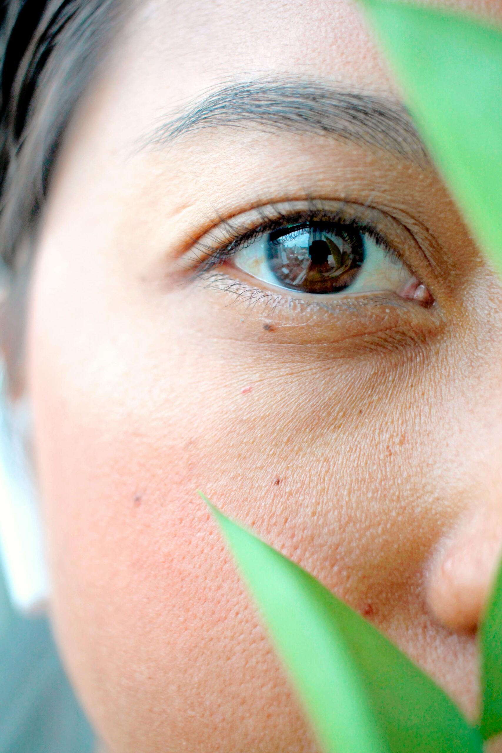 Close up of eye area showing crow’s feet wrinkles treated at Temecula medical spa