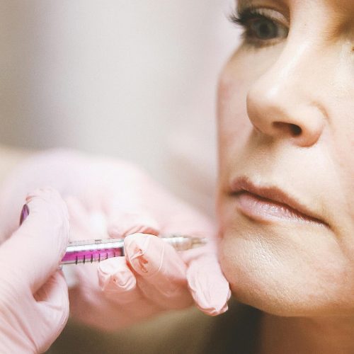 Chin dimpling consultation at Forever Young Medical Spa Temecula