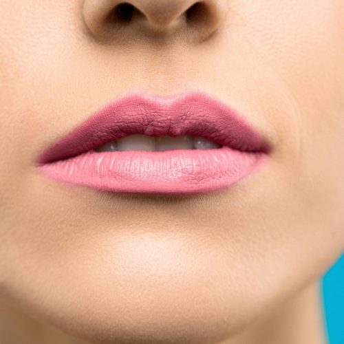 Beautiful natural smile after Lip Flip Botox treatment in Temecula medical spa